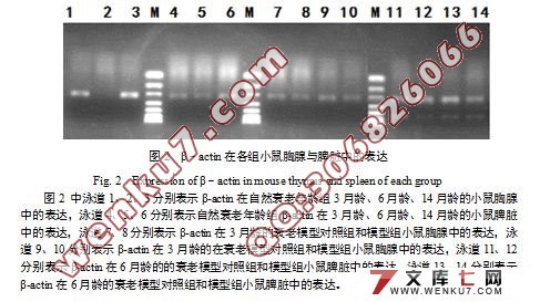 ϸSOCS3Gfi-1IL-2Gadd45Bcl2С˥Ϲеת¼о