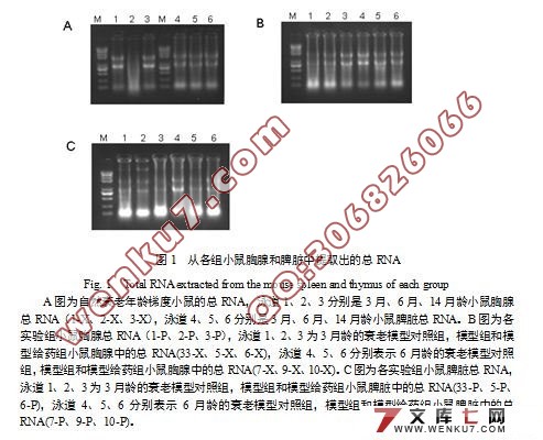 ϸSOCS3Gfi-1IL-2Gadd45Bcl2С˥Ϲеת¼о